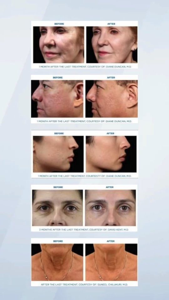 Instagram post from slimcaresolutions. This post is in position 3.